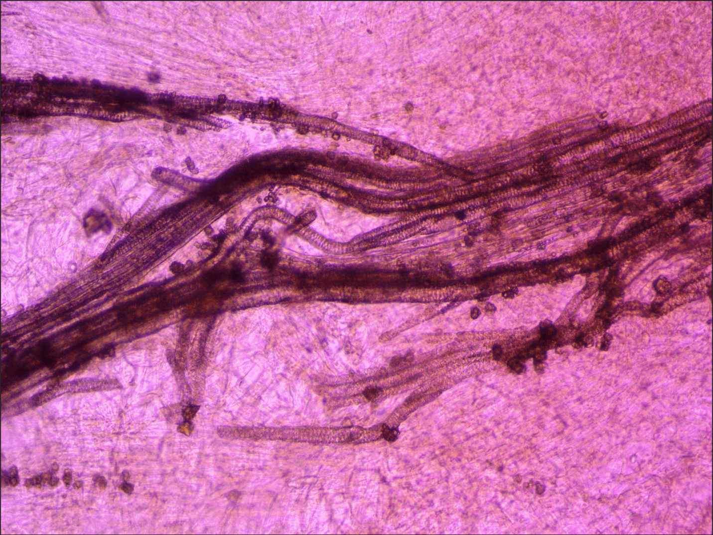 На этом фото обычная свекла в проходящем свете. Файл записан с помощью камеры UCMOS05100KPA. Объектив ахромат «бесконечность» 10х/0.25.