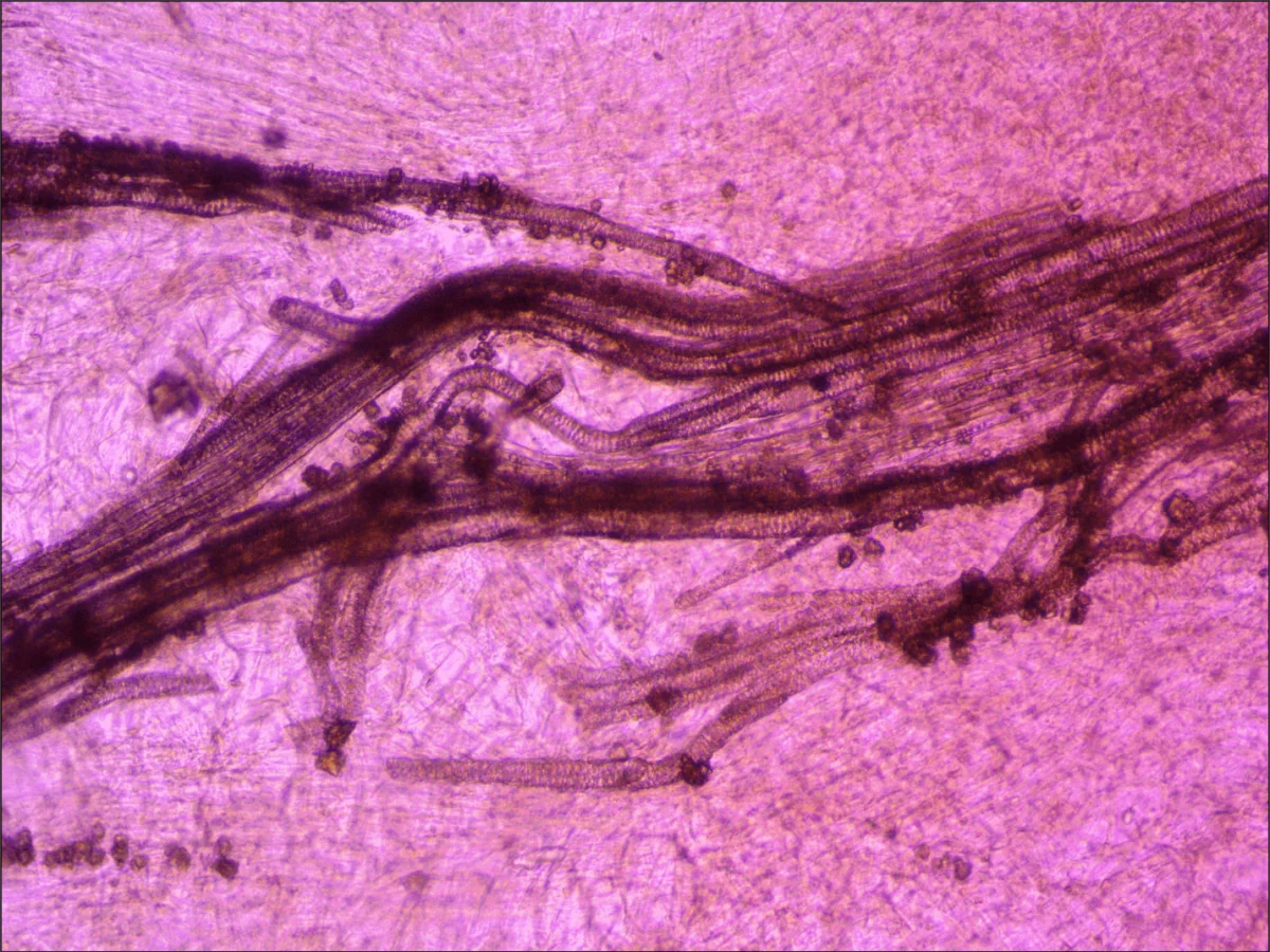 На этом фото обычная свекла в проходящем свете. Файл записан с помощью камеры UCMOS05100KPA. Объектив ахромат «бесконечность» 10х/0.25.